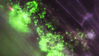 Kolonizacja komórek roślinnych przez bakterie azotowe zawarte w Encera