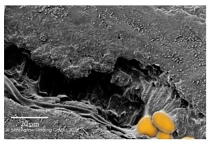 Mechanizm działania fungicydu biologicznego BOTECTOR®